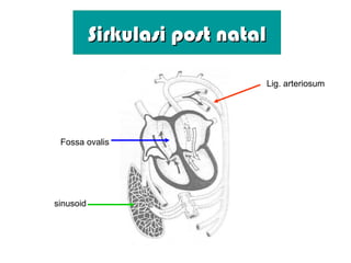 SirkulasiSirkulasi post natalpost natal
Lig. arteriosum
sinusoid
Fossa ovalis
 