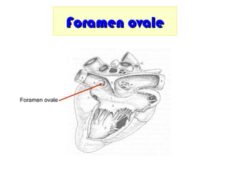 Foramen ovaleForamen ovale
Foramen ovale
 