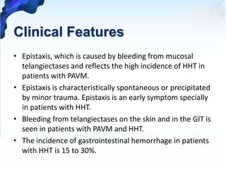 Clinical Features
• Epistaxis, which is caused by bleeding from mucosal
telangiectases and reflects the high incidence of HHT in
patients with PAVM.
• Epistaxis is characteristically spontaneous or precipitated
by minor trauma. Epistaxis is an early symptom specially
in patients with HHT.
• Bleeding from telangiectases on the skin and in the GIT is
seen in patients with PAVM and HHT.
• The incidence of gastrointestinal hemorrhage in patients
with HHT is 15 to 30%.
 