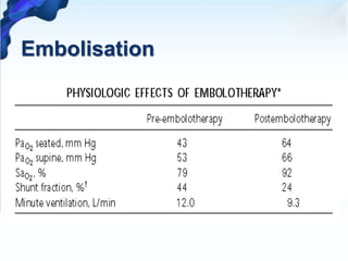Embolisation
 