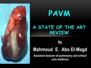 By
Mahmoud E. Abo El-Magd
Assistant lecturer of pulmonary and critical
care medicine
PAVM
A STATE OF THE ART
REVIEW
 