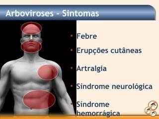 • Febre
• Erupções cutâneas
• Artralgia
• Síndrome neurológica
• Síndrome
hemorrágica
Arboviroses - Sintomas
 