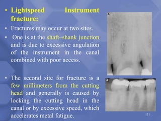 • Lightspeed Instrument
fracture:
• Fractures may occur at two sites.
• One is at the shaft–shank junction
and is due to excessive angulation
of the instrument in the canal
combined with poor access.
• The second site for fracture is a
few millimeters from the cutting
head and generally is caused by
locking the cutting head in the
canal or by excessive speed, which
accelerates metal fatigue. 131
 