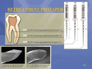 RETREATMENT PROTAPER
152
 