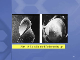 53
Flex - R file with modified rounded tip
 