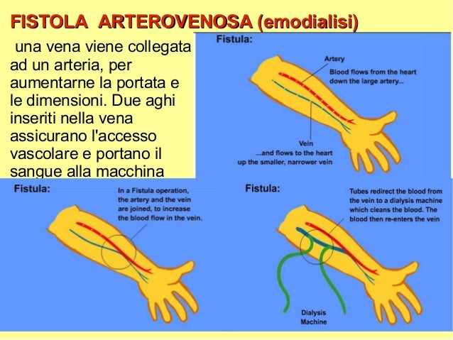 Clinica per trattamento di varicosity di vene