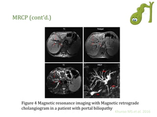 MRCP (cont’d.)
Figure 4 Magnetic resonance imaging with Magnetic retrograde
cholangiogram in a patient with portal biliopathy
Khuroo MS et al. 2016
 