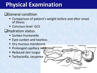 A Child with Vomiting (problem based approach) | PPTX