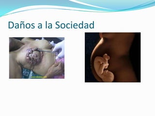 Daños a la Sociedad
 