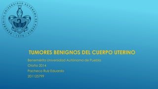 TUMORES BENIGNOS DEL CUERPO UTERINO 
Benemérita Universidad Autónoma de Puebla 
Otoño 2014 
Pacheco Ruiz Eduardo 
201125799 
 