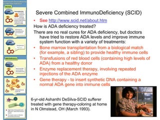 Severe Combined ImmunoDeficiency (SCID)
• See http://www.scid.net/about.htm
How is ADA deficiency treated?
There are no real cures for ADA deficiency, but doctors
have tried to restore ADA levels and improve immune
system function with a variety of treatments:
• Bone marrow transplantation from a biological match
(for example, a sibling) to provide healthy immune cells
• Transfusions of red blood cells (containing high levels of
ADA) from a healthy donor
• Enzyme replacement therapy, involving repeated
injections of the ADA enzyme
• Gene therapy - to insert synthetic DNA containing a
normal ADA gene into immune cells
6-yr-old Ashanthi DeSilva-SCID sufferer
treated with gene therapy-coloring at home
in N Olmstead, OH (March 1993).
 