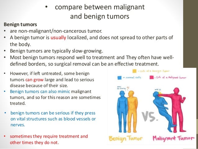 malignant and benign tumors the stages and grading of tumor type colon cancer mass size