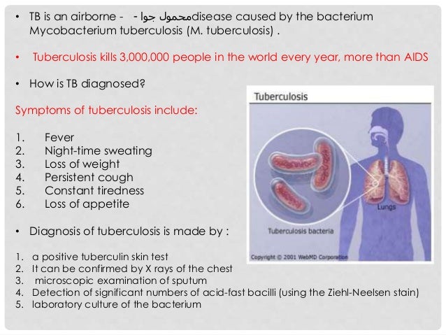 CDC | TB | Testing & Diagnosis