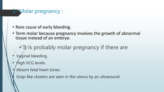 3- Molar pregnancy :
It is probably molar pregnancy if there are
• Vaginal bleeding.
• High hCG levels.
• Absent fetal heart tones.
• Grap-like clusters are seen in the uterus by an ultrasound.
• Rare cause of early bleeding.
• Term molar because pregnancy involves the growth of abnormal
tissue instead of an embryo.
 