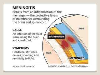 viral meningitis structure