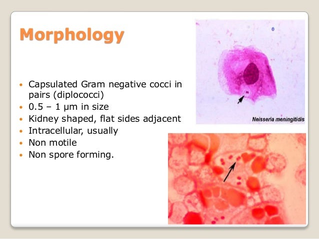 pbl 3 pod 1 the morphology and structure of neisseria meningitidis neisseria meningitidis