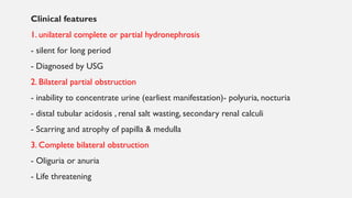 Clinical features
1. unilateral complete or partial hydronephrosis
- silent for long period
- Diagnosed by USG
2. Bilateral partial obstruction
- inability to concentrate urine (earliest manifestation)- polyuria, nocturia
- distal tubular acidosis , renal salt wasting, secondary renal calculi
- Scarring and atrophy of papilla & medulla
3. Complete bilateral obstruction
- Oliguria or anuria
- Life threatening
 