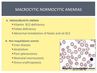 MACROCYTIC NORMOCYTIC ANEMIAS A.  MEGALOBLASTIC ANEMIA Vitamin  B12 deficiency Folate deficiency Abnormal metabolism of folate and vit B12 B.  Non megaloblastic anemia Liver disease Alcoholism Post splenoctomy Neonatal macrocytosis Stress erythropoiesis Wright’s stained blood smear 