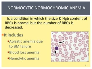 NORMOCYTIC NORMOCHROMIC ANEMIA It includes Aplastic anemia due to BM failure Blood loss anemia  Hemolytic anemia Is a condition in which the size & Hgb content of RBCs is normal but the number of RBCs is decreased. 