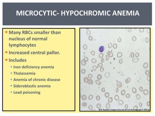 MICROCYTIC- HYPOCHROMIC ANEMIA Many RBCs smaller than nucleus of normal lymphocytes Increased central pallor. Includes  Iron deficiency anemia Thalassemia Anemia of chronic disease  Sideroblastic anemia Lead poisoning 