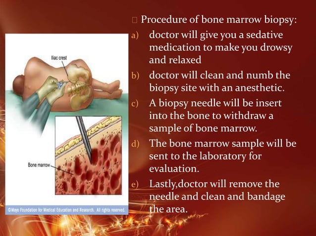 Bone Marrow PPT bone-marrow-ppt