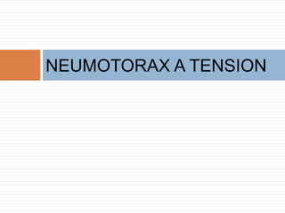 NEUMOTORAX A TENSION
 