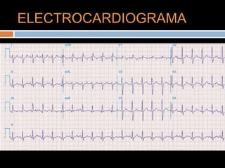 ELECTROCARDIOGRAMA
 