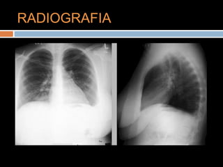 RADIOGRAFIA
 