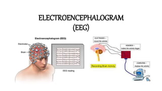 ELECTROENCEPHALOGRAM
(EEG)
 
