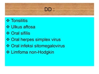 DD :
 Tonsilitis
 Ulkus aftosa
 Oral sifilis
 Oral herpes simplex virus
 Oral infeksi sitomegalovirus
 Limfoma non-Hodgkin
 