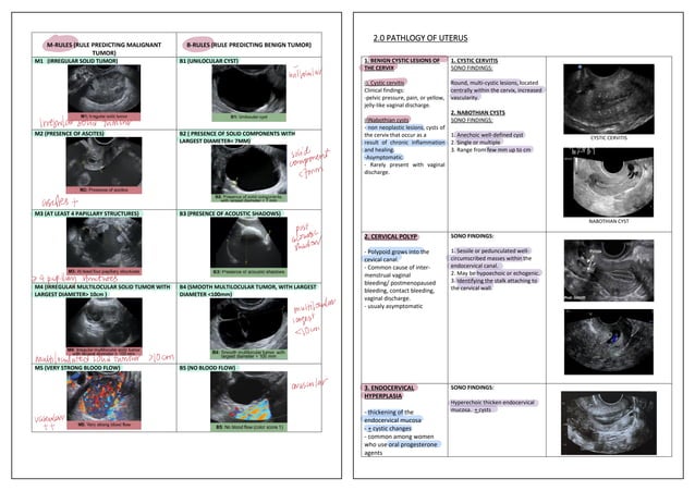 Ovarian pathology short notes quick study | PPT