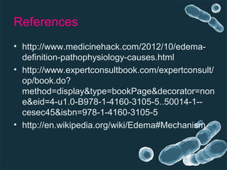 References
• http://www.medicinehack.com/2012/10/edema-
definition-pathophysiology-causes.html
• http://www.expertconsultbook.com/expertconsult/
op/book.do?
method=display&type=bookPage&decorator=non
e&eid=4-u1.0-B978-1-4160-3105-5..50014-1--
cesec45&isbn=978-1-4160-3105-5
• http://en.wikipedia.org/wiki/Edema#Mechanism
 