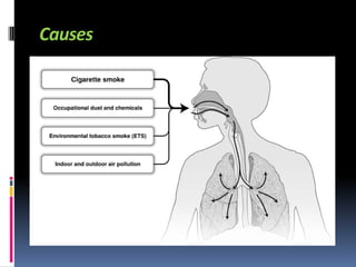 Causes
 
