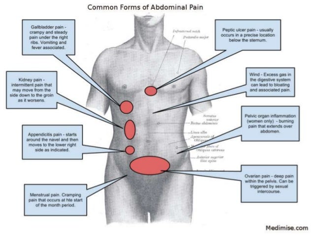 Acute Pancreatitis