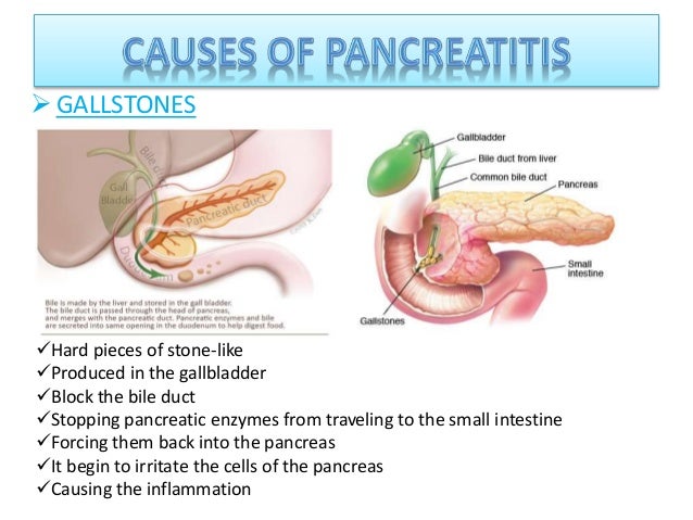 acute pancreatitis Pancreatitis is inflammation of the pancreas the pancreas is a large gland behind the stomach and close to the duodenum—the first part of the small intestine. acute pancreatitis Pancreatitis is inflammation of the pancreas the pancreas is a large gland behind the stomach and close to the duodenum—the first part of the small intestine.