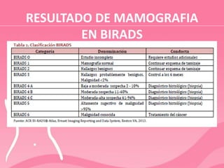RESULTADO DE MAMOGRAFIA
EN BIRADS
 