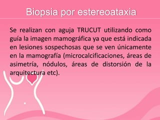 Biopsia por estereoataxia
Se realizan con aguja TRUCUT utilizando como
guía la imagen mamográfica ya que está indicada
en lesiones sospechosas que se ven únicamente
en la mamografía (microcalcificaciones, áreas de
asimetría, nódulos, áreas de distorsión de la
arquitectura etc).
 
