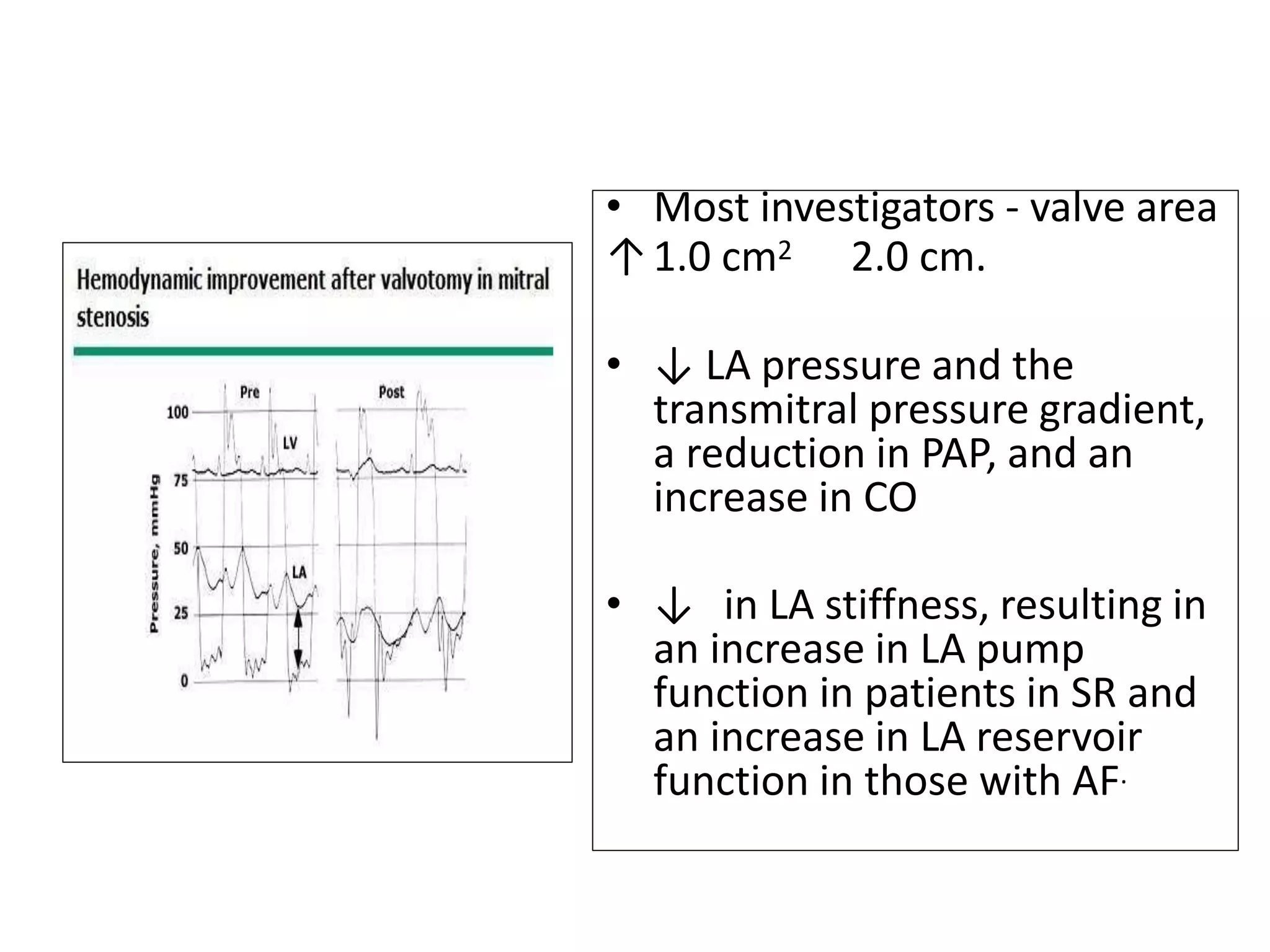 • Most investigators - valve area
↑1.0 cm2 2.0 cm.
• ↓ LA pressure and the
transmitral pressure gradient,
a reduction in PAP, and an
increase in CO
• ↓ in LA stiffness, resulting in
an increase in LA pump
function in patients in SR and
an increase in LA reservoir
function in those with AF.
 