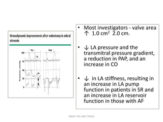 • Most investigators - valve area
↑ 1.0 cm2 2.0 cm.
• ↓ LA pressure and the
transmitral pressure gradient,
a reduction in PAP, and an
increase in CO
• ↓ in LA stiffness, resulting in
an increase in LA pump
function in patients in SR and
an increase in LA reservoir
function in those with AF.
PBMV TIPS AND TRICKS
 