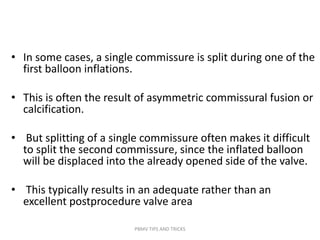• In some cases, a single commissure is split during one of the
first balloon inflations.
• This is often the result of asymmetric commissural fusion or
calcification.
• But splitting of a single commissure often makes it difficult
to split the second commissure, since the inflated balloon
will be displaced into the already opened side of the valve.
• This typically results in an adequate rather than an
excellent postprocedure valve area
PBMV TIPS AND TRICKS
 