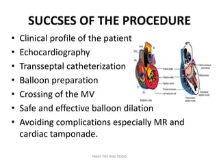 SUCCSES OF THE PROCEDURE
• Clinical profile of the patient
• Echocardiography
• Transseptal catheterization
• Balloon preparation
• Crossing of the MV
• Safe and effective balloon dilation
• Avoiding complications especially MR and
cardiac tamponade.
PBMV TIPS AND TRICKS
 