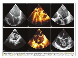 PBMV TIPS AND TRICKS
 