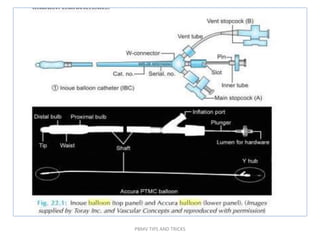 PBMV TIPS AND TRICKS
 