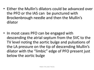 • Either the Mullin’s dilators could be advanced over
the PFO or the IAS can be punctured with
Brockenbrough needle and then the Mullin’s
dilator
• In most cases PFO can be engaged with
descending the atrial septum from the SVC to the
TV level noting the aortic bulge and pulsations of
the LA pressure on the tip of descending Mullin’s
dilator with the “limbic” edge of PFO present just
below the aortic bulge
PBMV TIPS AND TRICKS
 