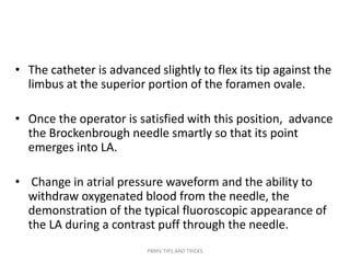 • The catheter is advanced slightly to flex its tip against the
limbus at the superior portion of the foramen ovale.
• Once the operator is satisfied with this position, advance
the Brockenbrough needle smartly so that its point
emerges into LA.
• Change in atrial pressure waveform and the ability to
withdraw oxygenated blood from the needle, the
demonstration of the typical fluoroscopic appearance of
the LA during a contrast puff through the needle.
PBMV TIPS AND TRICKS
 