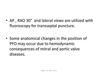 • AP , RAO 30° and lateral views are utilized with
fluoroscopy for transseptal puncture.
• Some anatomical changes in the position of
PFO may occur due to hemodynamic
consequences of mitral and aortic valve
diseases.
PBMV TIPS AND TRICKS
 