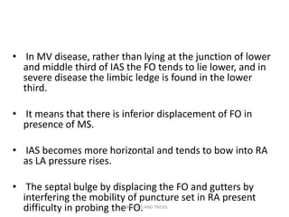• In MV disease, rather than lying at the junction of lower
and middle third of IAS the FO tends to lie lower, and in
severe disease the limbic ledge is found in the lower
third.
• It means that there is inferior displacement of FO in
presence of MS.
• IAS becomes more horizontal and tends to bow into RA
as LA pressure rises.
• The septal bulge by displacing the FO and gutters by
interfering the mobility of puncture set in RA present
difficulty in probing the FO.PBMV TIPS AND TRICKS
 
