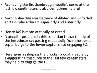 • Reshaping the Brockenbrough needle’s curve at the
last few centimeters is also sometimes helpful
• Aortic valve diseases because of dilated and unfolded
aorta displace the FO superiorly and anteriorly.
• Hence IAS is more vertically oriented.
• A peculiar problem in this condition is that the tip of
the introducer set passing repeatedly from the aortic
septal bulge to the lower septum, not engaging FO.
• Here again reshaping the Brockenbrough needle by
exaggerating the curve of the last few centimeters
may help to engage the FO
PBMV TIPS AND TRICKS
 