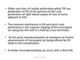 • Other rare sites of cardiac perforation while TSP are
perforation of RA at the junction of SVC and
perforation of right lateral aspect of root of aorta
adjacent to SVC.
• The common mechanism in RA and aortic root
perforation is the superior slipping of the transseptal
set along the IAS until it is held by crista terminalis.
• At this point misinterpretation of resistance to further
advancement of transseptal set being offered by FO
leads to this complication.
• A similar misunderstanding can occur with a thick IAS.
PBMV TIPS AND TRICKS
 