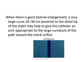 When there is giant biatrial enlargement, a very
large curve 20–30 cm proximal to the distal tip
of the stylet may help to give the catheter an
arch appropriate to the large curvature of the
path toward the mitral orifice
PBMV TIPS AND TRICKS
 